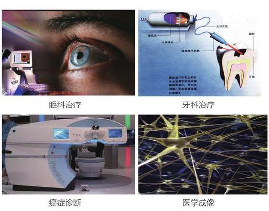 图6 飞秒激光（超强超短激光）治疗近视，来源：公有领域