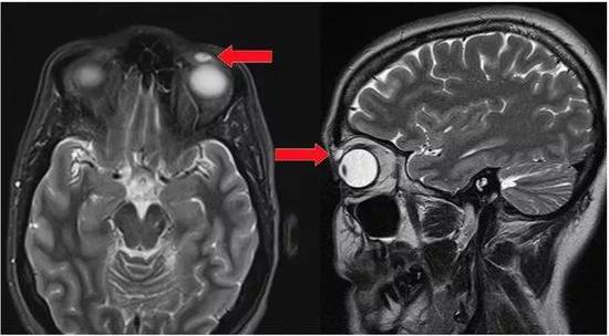Credit： BMJ Case Reports 2018