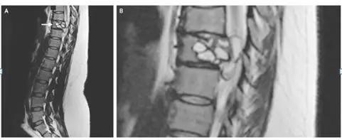 Credit： The New England Journal of Medicine