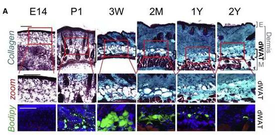 绿色代表的是dWAT，随着小鼠年龄增加，dWAT在不断减少。图片来源文献。