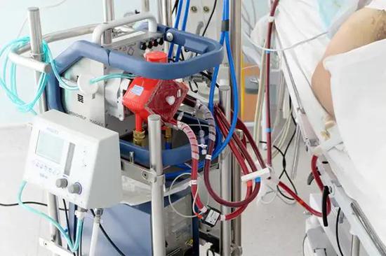 图10。 叶克膜仪器。来源：https：//www.medpagetoday.com/infectiousdisease/covid19/86003