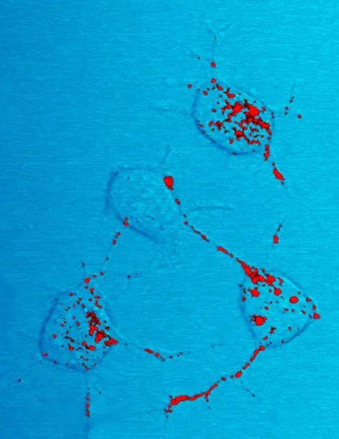 朊蛋白（红色）能表现出传染性，引发神经退行性疾病。图中的 4 个小鼠神经细胞展示了传染性朊蛋白如何沿着神经突扩散。图片来源：NIAID， CC BY 2.0